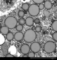 psTEM_liver cells